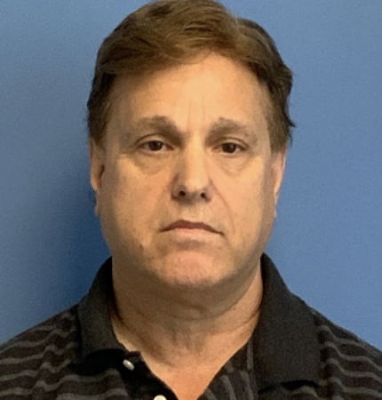 Face--amp--Neck-lift | Before Facelift